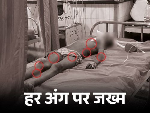 5 कुत्र्यांनी चावून चावून मुलाचा जीव घेतला:शरीराच्या प्रत्येक भागावर चावले, वडिलांनी सोडवले; आईसोबत शेतात गेला होता