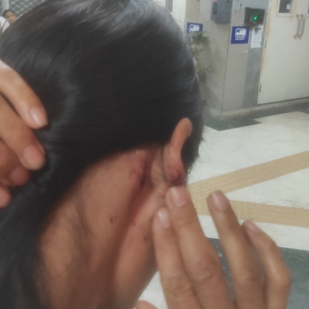 दिल्ली- मणिपूरच्या महिलेला आणि तिच्या मित्रांना मारहाण:मेघालयच्या मुख्यमंत्र्यांनी पोलिस सुरक्षेवर व्यक्त केली नाराजी, पोलिसांनी मुख्यमंत्र्यांना उत्तर दिले