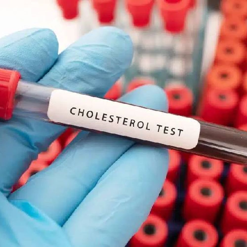 अमेरिका: कार्डिओलॉजी कॉलेजने कोलेस्ट्रॉलवर मार्गदर्शक तत्त्वे जारी केली:आता 19 वर्षांच्या वयापासून कोलेस्ट्रॉल चाचणी, वेळेवर सतर्कतेमुळे हृदय दीर्घकाळ सुरक्षित