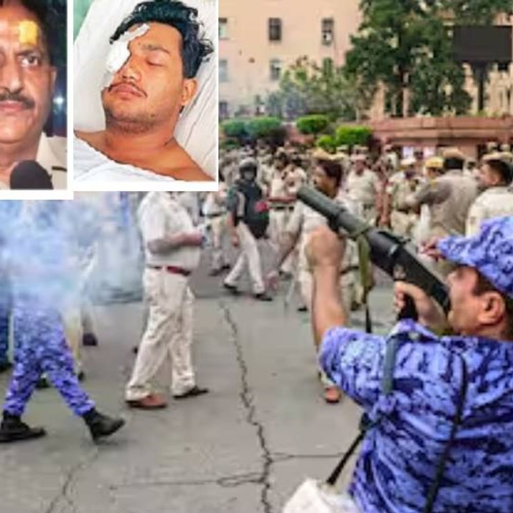 पेपर लीक:निदर्शन करणाऱ्या युवकाच्या डोळ्यात छर्रे; दृष्टी संकटात, पोलिस-आंदोलक दोघेही जखमी