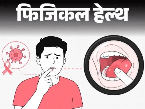 तोंडात फोड, वेदना कर्करोग तर नाही?:जाणून घ्या हे कधी धोक्याचे लक्षण, कधी डॉक्टरांना दाखवणे आवश्यक, कुणाला जास्त धोका?
